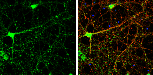 USP14 antibody detects USP14 protein by immunofluorescent analysis. Sample: DIV14 rat E18 primary cortical neurons were fixed in 4% paraformaldehyde at RT for 15 min. Green: USP14 protein stained by USP14 antibody (GTX115187) diluted at 1:500. Red: beta Tubulin 3/ Tuj1, stained by beta Tubulin 3/ Tuj1 antibody [GT1338] (GTX631831) diluted at 1:500. Blue: Fluoroshield with DAPI (GTX30920).
