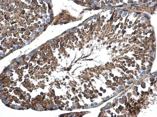 AP4M1 antibody [N1C1] detects AP4M1 protein at cytoplasm in mouse testis by immunohistochemical analysis. Sample: Paraffin-embedded mouse testis. AP4M1 antibody [N1C1] (GTX115196) diluted at 1:500. 
 Antigen Retrieval: Citrate buffer, pH 6.0, 15 min