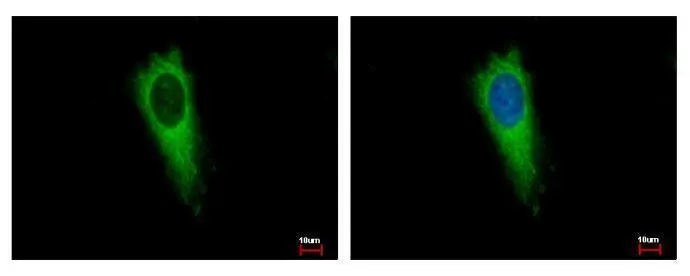 AIMP1 antibody detects SCYE1 protein at Cytoplasm by immunofluorescent analysis.Sample: HeLa cells were fixed in 4% paraformaldehyde at RT for 15 min.Green: SCYE1 protein stained by AIMP1 antibody (GTX115209) diluted at 1:500.Blue: Hoechst 33343 staining.
