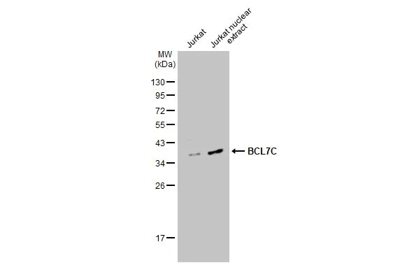 Jurkat whole cell and nuclear extracts (30 μg) were separated by 12% SDS-PAGE, and the membrane was blotted with BCL7C antibody (GTX115214) diluted at 1:500. The HRP-conjugated anti-rabbit IgG antibody (GTX213110-01) was used to detect the primary antibody.