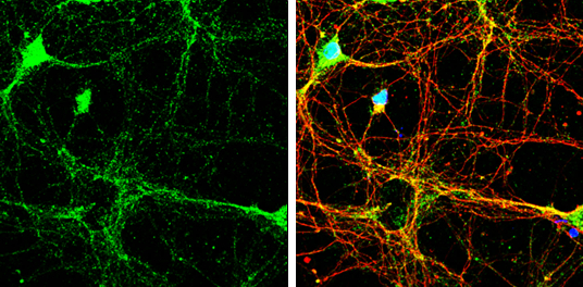 Homer3 antibody detects Homer3 protein by immunofluorescent analysis. Sample: DIV9 rat E18 primary cortical neurons were fixed in 4% paraformaldehyde at RT for 15 min. Green: Homer3 protein stained by Homer3 antibody (GTX115242) diluted at 1:500. Red: beta Tubulin 3/ Tuj1, stained by beta Tubulin 3/ Tuj1 antibody [GT886] (GTX631830) diluted at 1:500. Blue: Fluoroshield with DAPI (GTX30920).