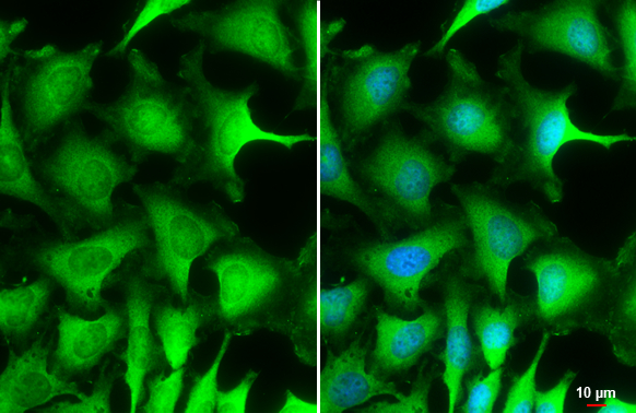 NPEPPS antibody [N3C2-2], Internal detects NPEPPS protein at cytoplasm by immunofluorescent analysis. Sample: HeLa cells were fixed in 4% paraformaldehyde at RT for 15 min. Green: NPEPPS stained by NPEPPS antibody [N3C2-2], Internal (GTX115247) diluted at 1:500. Blue: Fluoroshield with DAPI (GTX30920). Scale bar= 10 μm.