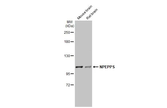 Various tissue extracts (50 μg) were separated by 5% SDS-PAGE, and the membrane was blotted with NPEPPS antibody [N3C2-2], Internal (GTX115247) diluted at 1:500. The HRP-conjugated anti-rabbit IgG antibody (GTX213110-01) was used to detect the primary antibody.