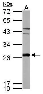 Sample (30 ug of whole cell lysate) A: HCT116 12% SDS PAGE GTX115262 diluted at 1:1000 The HRP-conjugated anti-rabbit IgG antibody (GTX213110-01) was used to detect the primary antibody.