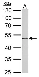 Guanine deaminase antibody detects Guanine deaminase protein by Western blot analysis. A. 50 μg mouse colon lysate/extract 10 % SDS-PAGE Guanine deaminase antibody (GTX115264) dilution: 1:1000