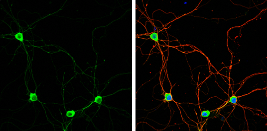Pumilio 1 antibody [C2C3], C-term detects Pumilio 1 protein by immunofluorescent analysis. Sample: DIV9 rat E18 primary hippocampal neuron cells were fixed in 4% paraformaldehyde at RT for 15 min. Green: Pumilio 1 stained by Pumilio 1 antibody [C2C3], C-term (GTX115280) diluted at 1:500. Red: beta Tubulin 3/ Tuj1, stained by beta Tubulin 3/ Tuj1 antibody [GT11710] (GTX631836) diluted at 1:500. Blue: Fluoroshield with DAPI (GTX30920).