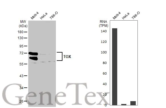 Various whole cell extracts (30 μg) were separated by 10% SDS-PAGE, and the membrane was blotted with TOX antibody [N1C1] (GTX115287) diluted at 1:1000. The HRP-conjugated anti-rabbit IgG antibody (GTX213110-01) was used to detect the primary antibody. Corresponding RNA expression data for the same cell lines are based on Human Protein Atlas program.