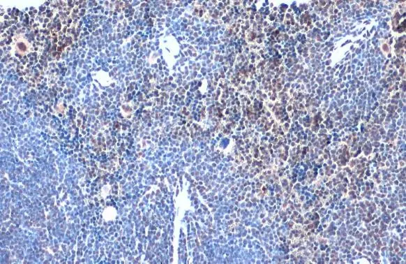TOX antibody [N1C1] detects TOX protein at nucleus by immunohistochemical analysis. Sample: Paraffin-embedded mouse lymph node. TOX stained by TOX antibody [N1C1] (GTX115287) diluted at 1:500. Antigen Retrieval: Citrate buffer, pH 6.0, 15 min