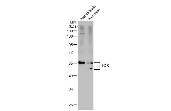 Various tissue extracts (50 μg) were separated by 10% SDS-PAGE, and the membrane was blotted with TOX antibody [N1C1] (GTX115287) diluted at 1:1000. The HRP-conjugated anti-rabbit IgG antibody (GTX213110-01) was used to detect the primary antibody.