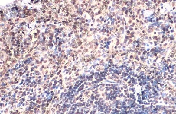 TOX antibody [N1C1] detects TOX protein at nucleus by immunohistochemical analysis. Sample: Paraffin-embedded mouse spleen. TOX stained by TOX antibody [N1C1] (GTX115287) diluted at 1:500. Antigen Retrieval: Citrate buffer, pH 6.0, 15 min