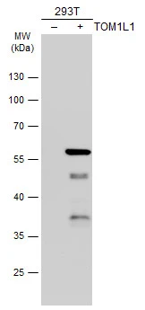 Non-transfected (–) and transfected (+) 293T whole cell extracts (30 μg) were separated by 10% SDS-PAGE, and the membrane was blotted with TOM1L1 antibody [N2C2], Internal (GTX115333) diluted at 1:5000. The HRP-conjugated anti-rabbit IgG antibody (GTX213110-01) was used to detect the primary antibody.