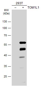 Non-transfected (–) and transfected (+) 293T whole cell extracts (30 μg) were separated by 10% SDS-PAGE, and the membrane was blotted with TOM1L1 antibody (GTX115334) diluted at 1:5000. The HRP-conjugated anti-rabbit IgG antibody (GTX213110-01) was used to detect the primary antibody.