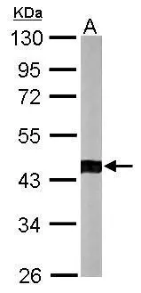 Sample (50 ug of whole cell lysate) A: mouse brain 10% SDS PAGE GTX115347 diluted at 1:1000 Sample (50 ug of whole cell lysate) A: mouse brain 10% SDS PAGE GTX115347 diluted at 1:1000