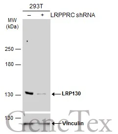 Non-transfected (–) and transfected (+) 293T whole cell extracts (30 μg) were separated by 5% SDS-PAGE, and the membrane was blotted with LRP130 antibody [N2N3] (GTX115351) diluted at 1:5000. The HRP-conjugated anti-rabbit IgG antibody (GTX213110-01) was used to detect the primary antibody, and the signal was developed with Trident ECL plus-Enhanced.