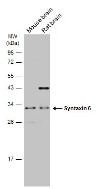 Various tissue extracts (50 μg) were separated by 12% SDS-PAGE, and the membrane was blotted with Syntaxin 6 antibody [N1C3] (GTX115375) diluted at 1:1000. The HRP-conjugated anti-rabbit IgG antibody (GTX213110-01) was used to detect the primary antibody.
