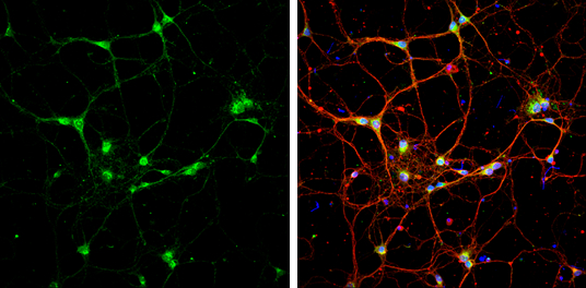 Syntaxin 6 antibody [N1C3] detects Syntaxin 6 protein at cytoplasm by immunofluorescent analysis. Sample: DIV9 rat E18 primary cortical neurons were fixed in 4% paraformaldehyde at RT for 15 min. Green: Syntaxin 6 protein stained by Syntaxin 6 antibody [N1C3] (GTX115375) diluted at 1:500. Red: beta Tubulin 3/ Tuj1, a neuron cell marker, stained by beta Tubulin 3/ Tuj1 antibody [GT11710] (GTX631836) diluted at 1:500. Blue: Fluoroshield with DAPI (GTX30920).