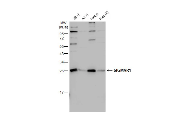 SIGMAR1 antibody [N1C3]