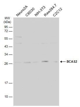 Various whole cell extracts (30 μg) were separated by 12% SDS-PAGE, and the membrane was blotted with BCAS2 antibody (GTX115390) diluted at 1:1000. The HRP-conjugated anti-rabbit IgG antibody (GTX213110-01) was used to detect the primary antibody.