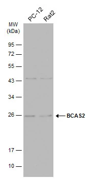 Various whole cell extracts (30 μg) were separated by 12% SDS-PAGE, and the membrane was blotted with BCAS2 antibody (GTX115390) diluted at 1:1000. The HRP-conjugated anti-rabbit IgG antibody (GTX213110-01) was used to detect the primary antibody.