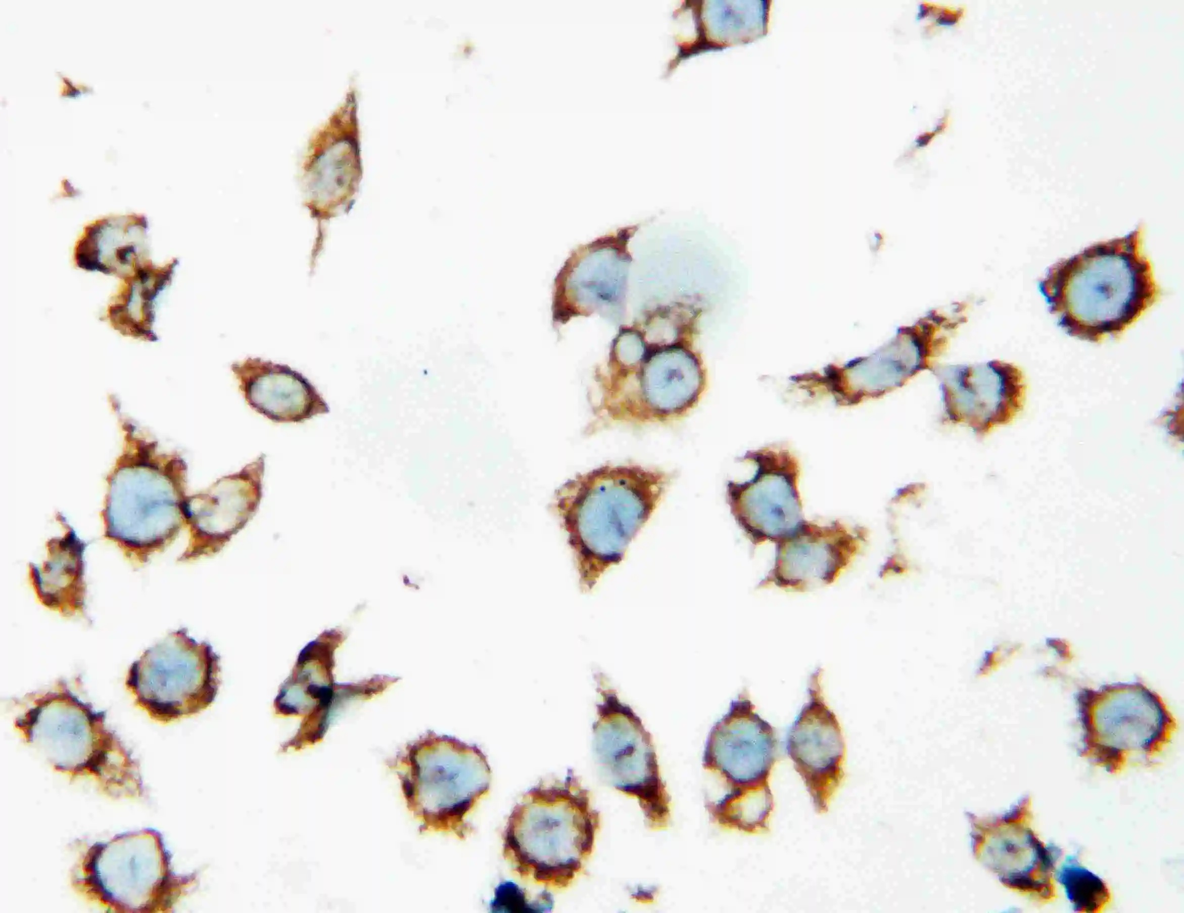 ICC/IF analysis of SMMC cell using GTX11540 HSP60 antibody. ICC/IF analysis of SMMC cell using GTX11540 HSP60 antibody.
