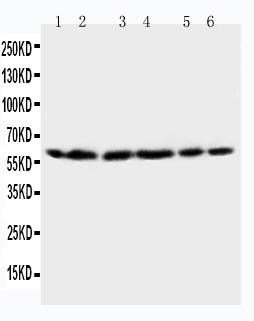 WB analysis of various samples using GTX11540 HSP60 antibody. Lane 1 : rat brain tissue lysate Lane 2 : rat liver tissue lysate Lane 3 : CEM cell lysate Lane 4 : HeLa cell lysate Lane 5 : SMMC cell lysate Lane 6 : COLO320 cell lysate