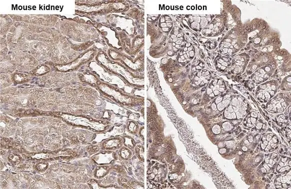 beta Tubulin 2C antibody [C1C3] detects beta Tubulin 2C protein by immunohistochemical analysis. Sample: Paraffin-embedded mouse tissues. beta Tubulin 2C stained by beta Tubulin 2C antibody [C1C3] (GTX115404) diluted at 1:500. Antigen Retrieval: Citrate buffer, pH 6.0, 15 min