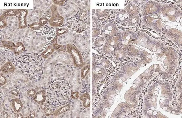 beta Tubulin 2C antibody [C1C3] detects beta Tubulin 2C protein by immunohistochemical analysis. Sample: Paraffin-embedded rat tissues. beta Tubulin 2C stained by beta Tubulin 2C antibody [C1C3] (GTX115404) diluted at 1:500. Antigen Retrieval: Citrate buffer, pH 6.0, 15 min