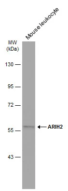 Mouse tissue extract (50 μg) was separated by 7.5% SDS-PAGE, and the membrane was blotted with ARIH2 antibody (GTX115410) diluted at 1:1000. The HRP-conjugated anti-rabbit IgG antibody (GTX213110-01) was used to detect the primary antibody.