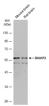 Various tissue extracts (50 μg) were separated by 10% SDS-PAGE, and the membrane was blotted with BAIAP2 antibody (GTX115421) diluted at 1:10000. The HRP-conjugated anti-rabbit IgG antibody (GTX213110-01) was used to detect the primary antibody.