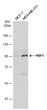 Various whole cell extracts (30 μg) were separated by 7.5% SDS-PAGE, and the membrane was blotted with PIBF1 antibody (GTX115423) diluted at 1:1000. The HRP-conjugated anti-rabbit IgG antibody (GTX213110-01) was used to detect the primary antibody.
