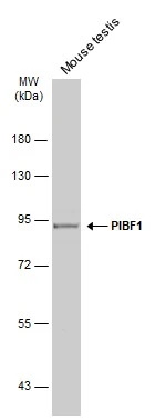 Mouse tissue extract (50 μg) was separated by 7.5% SDS-PAGE, and the membrane was blotted with PIBF1 antibody (GTX115423) diluted at 1:1000. The HRP-conjugated anti-rabbit IgG antibody (GTX213110-01) was used to detect the primary antibody.