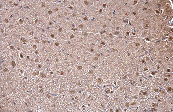 SAM68 antibody [N2C3] detects SAM68 protein at nucleus by immunohistochemical analysis. Sample: Paraffin-embedded mouse brain. SAM68 stained by SAM68 antibody [N2C3] (GTX115462) diluted at 1:500. Antigen Retrieval: Trilogy?M (EDTA based) buffer, 15min