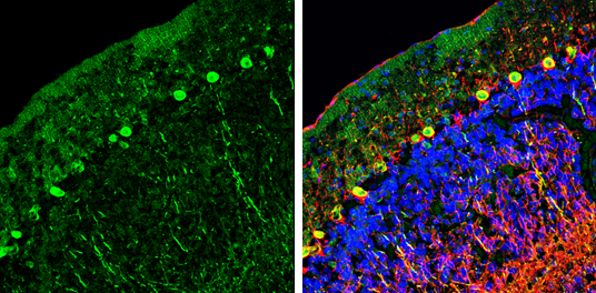 NCKAP1 antibody [N1N2], N-term detects NCKAP1 protein by immunohistochemical analysis. Sample: Frozen-sectioned mouse cerebellum. Green: NCKAP1 stained by NCKAP1 antibody [N1N2], N-term (GTX115481) diluted at 1:250. Red: NF-H, stained by NF-H antibody [GT114] (GTX634289) diluted at 1:500. Blue: Fluoroshield with DAPI (GTX30920).