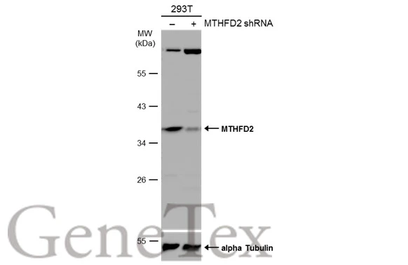 Non-transfected (–) and transfected (+) 293T whole cell extracts (30 μg) were separated by 10% SDS-PAGE, and the membrane was blotted with MTHFD2 antibody [N3C3] (GTX115482) diluted at 1:2000. The HRP-conjugated anti-rabbit IgG antibody (GTX213110-01) was used to detect the primary antibody, and the signal was developed with Trident ECL plus-Enhanced.