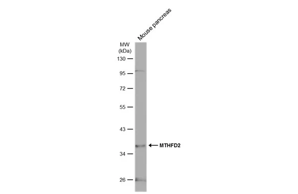 Whole cell extract (50 μg) was separated by 10% SDS-PAGE, and the membrane was blotted with MTHFD2 antibody [N3C3] (GTX115482) diluted at 1:1000. The HRP-conjugated anti-rabbit IgG antibody (GTX213110-01) was used to detect the primary antibody.