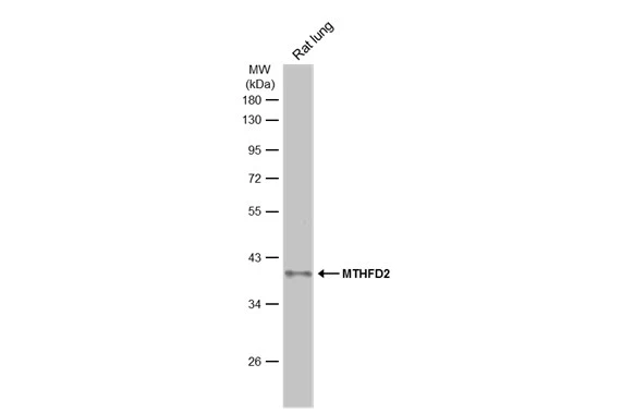Whole cell extract (50 μg) was separated by 10% SDS-PAGE, and the membrane was blotted with MTHFD2 antibody [N3C3] (GTX115482) diluted at 1:1000. The HRP-conjugated anti-rabbit IgG antibody (GTX213110-01) was used to detect the primary antibody, and the signal was developed with Trident ECL plus-Enhanced.