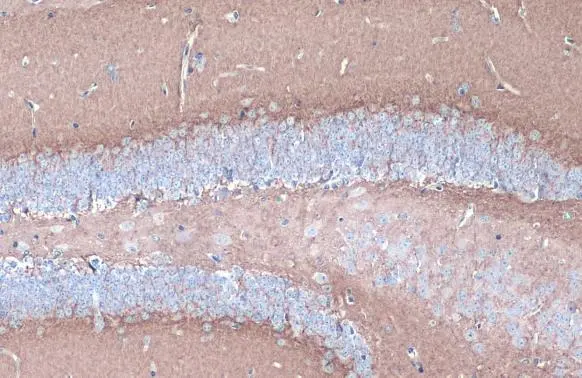 CYP46A1 antibody [N1C1] detects CYP46A1 protein at cytoplasm by immunohistochemical analysis. Sample: Paraffin-embedded mouse hippocampus. CYP46A1 stained by CYP46A1 antibody [N1C1] (GTX115492) diluted at 1:500. Antigen Retrieval: Citrate buffer, pH 6.0, 15 min