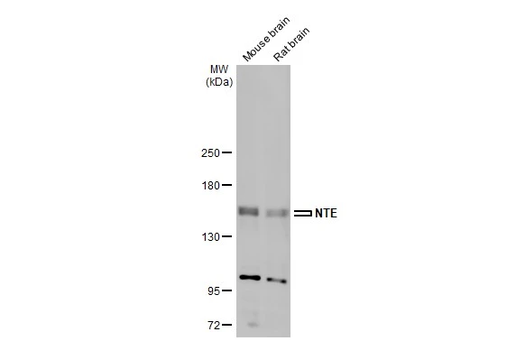 Various tissue extracts (50 μg) were separated by 5% SDS-PAGE, and the membrane was blotted with NTE antibody (GTX115501) diluted at 1:1000. The HRP-conjugated anti-rabbit IgG antibody (GTX213110-01) was used to detect the primary antibody, and the signal was developed with Trident ECL plus-Enhanced.