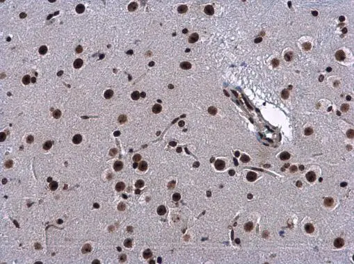 CBX1 / HP1 beta antibody detects CBX1 / HP1 beta protein at nucleus in mouse brain by immunohistochemical analysis. Sample: Paraffin-embedded mouse brain. CBX1 / HP1 beta antibody (GTX115510) diluted at 1:500. 
 Antigen Retrieval: Citrate buffer, pH 6.0, 15 min