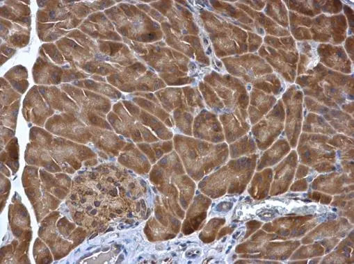 PDIR antibody [N1N3] detects PDIR protein at cytoplasm in mouse pancreas by immunohistochemical analysis. Sample: Paraffin-embedded mouse pancreas. PDIR antibody [N1N3] (GTX115511) diluted at 1:500. 
 Antigen Retrieval: Citrate buffer, pH 6.0, 15 min