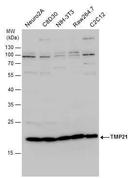 TMP21 antibody detects TMP21 protein by western blot analysis. Various whole cell extracts (30 μg) were separated by 12% SDS-PAGE, and the membrane was blotted with TMP21 antibody (GTX115517) diluted by 1:1000.