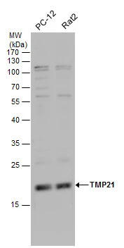 TMP21 antibody detects TMP21 protein by western blot analysis. Various whole cell extracts (30 ug) were separated by 12% SDS-PAGE,and the membrane was blotted with TMP21 antibody (GTX115517) diluted by 1:1000.