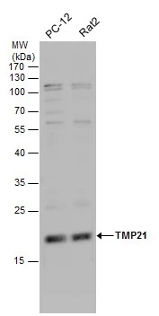 TMP21 antibody detects TMP21 protein by western blot analysis. Various whole cell extracts (30 μg) were separated by 12% SDS-PAGE, and the membrane was blotted with TMP21 antibody (GTX115517) diluted by 1:1000.