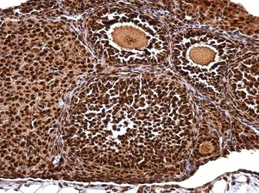 NUDT21 antibody detects NUDT21 protein at nucleus on mouse ovary by immunohistochemical analysis. Sample: Paraffin-embedded mouse ovary. NUDT21 antibody (GTX115535) dilution: 1:500. 
 Antigen Retrieval: Trilogy? (EDTA based, pH 8.0) buffer, 15min