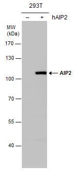 AIP2 antibody detects AIP2 protein by western blot analysis. Non-transfected (-) and AIP2 transfected (+) 293T whole cell extracts (30 μg) were separated by 10% SDS-PAGE, and the membrane was blotted with AIP2 antibody (GTX115540) diluted at 1:500.