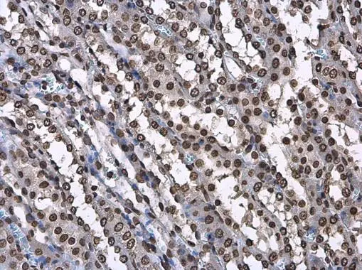Histone H3.3B antibody detects Histone H3.3B protein at nucleus in rat kidney by immunohistochemical analysis. Sample: Paraffin-embedded rat kidney. Histone H3.3B antibody (GTX115549) diluted at 1:500.
Antigen Retrieval: Citrate buffer, pH 6.0, 15 min Histone H3.3B antibody detects Histone H3.3B protein at nucleus in rat kidney by immunohistochemical analysis. Sample: Paraffin-embedded rat kidney. Histone H3.3B antibody (GTX115549) diluted at 1:500.
Antigen Retrieval: Citrate buffer, pH 6.0, 15 min