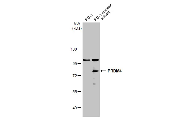 PC-3 whole cell and nuclear extracts (30 μg) were separated by 7.5% SDS-PAGE, and the membrane was blotted with PRDM4 antibody (GTX115579) diluted at 1:50000. The HRP-conjugated anti-rabbit IgG antibody (GTX213110-01) was used to detect the primary antibody.