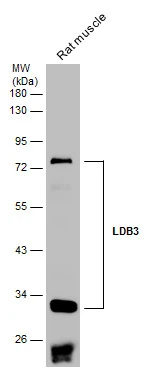 Rat tissue extract (50 μg) was separated by 10% SDS-PAGE, and the membrane was blotted with LDB3 antibody (GTX115593) diluted at 1:1000. The HRP-conjugated anti-rabbit IgG antibody (GTX213110-01) was used to detect the primary antibody.