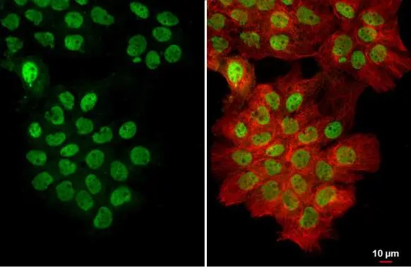 U2AF65 antibody [C1C3] detects U2AF65 protein at nucleus by immunofluorescent analysis. Sample: A431 cells were fixed in 4% paraformaldehyde at RT for 15 min. Green: U2AF65 stained by U2AF65 antibody [C1C3] (GTX115622) diluted at 1:500. Red: alpha Tubulin, a cytoskeleton marker, stained by alpha Tubulin antibody [GT114] (GTX628802) diluted at 1:1000.