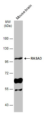Mouse tissue extract (50 μg) was separated by 7.5% SDS-PAGE, and the membrane was blotted with RASA3 antibody [C2C3], C-term (GTX115632) diluted at 1:1000. The HRP-conjugated anti-rabbit IgG antibody (GTX213110-01) was used to detect the primary antibody.